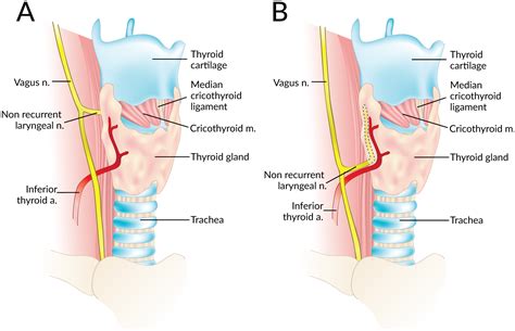 Recurrent Laryngeal Nerve Anatomy