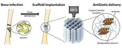 Scientists embed antibiotics in the 3D printe | EurekAlert!