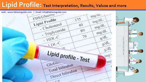 Lipid Profile Test Interpretation, Results, Valuse and more | Lab Tests Guide | Lipid profile ...