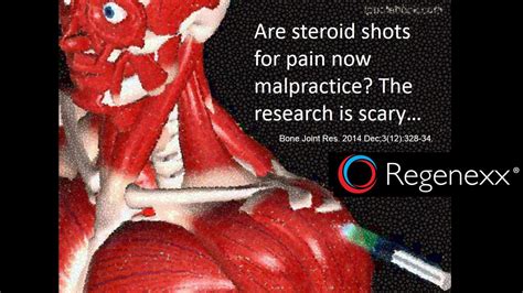 Shoulder Steroid Injection Side Effects: Shocking New Research! - Regenexx®