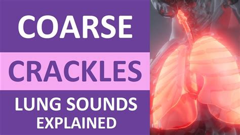 Coarse Crackles Lung Sounds Audio, Causes, Auscultation, Nursing NCLEX Review - YouTube