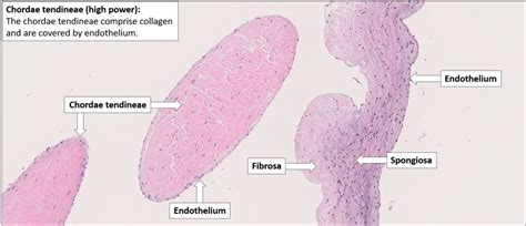 Atrioventricular valve with chordae tendineae – Normal Histology – NUS ...