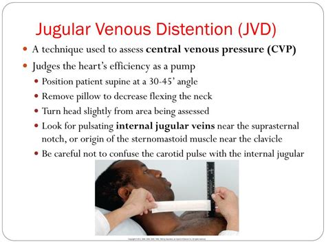 Jugular Venous Pressure Causes