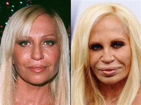 29 Hollywood Celebrities Who Have Spent Thousands On Cosmetic Surgery - Page 21 of 30 - True ...