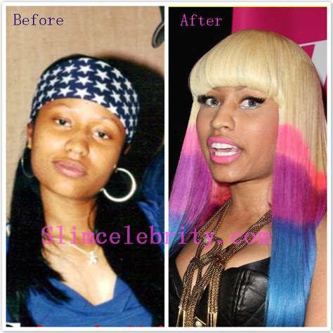 NICKI MINAJ BEFORE AND AFTER PLASTIC SURGERY | TERRY'S BLOG