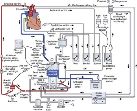 heart lung machine