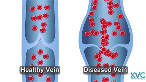 Treating Venous Disorders In Hawaii Since [2005]