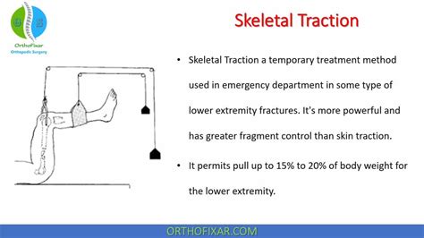 Skeletal Traction OrthoFixar 2023, 42% OFF