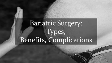 Bariatric Surgery: Types, Benefits, Complications - Yo Nature