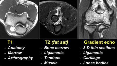 How Long Does An Elbow Mri Take : The elbow joint is a hinge joint with ...