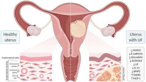 Frontiers | Understanding the Impact of Uterine Fibroids on Human Endometrium Function