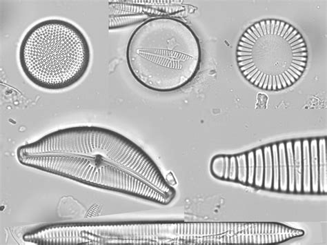 Diatoms Microscope