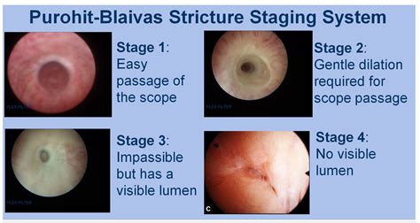 pic1 Urocenter of New York | Jerry G. Blaivas, MD, FACS