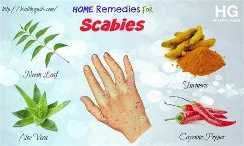 14 Home Remedies For Scabies On Skin & Scalp In Children & Adults