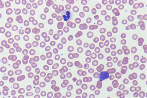 Hematopathology