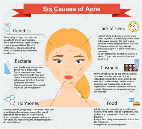 What Causes Acne - 6 Surprising Reasons Your Face Breaks Out | Acne ...