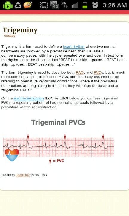 Ekg Trigeminy | Nurse quotes, Nursing mnemonics, Nursing notes