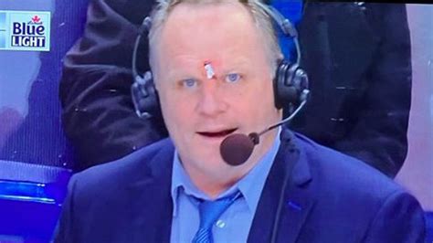 NHL analyst Rob Ray suffers horror head cut after being hit by puck ...