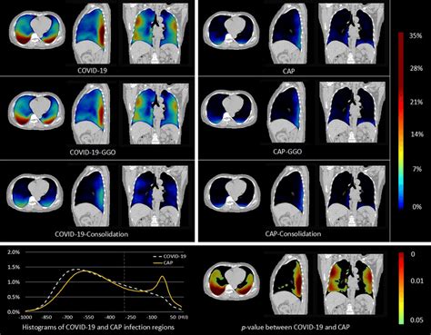 The distribution maps for COVID-19 (first row, left) and CAP (first ...