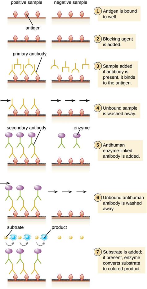 20.4: Enzyme Immunoassays (EIA) and Enzyme-Linked Immunosorbent Assays (ELISA) - Biology ...