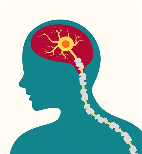 Could What Makes Multiple Sclerosis Worse Lead to a Cure? | UC San ...