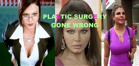 Bollywood Rakhi Sawant before and after plastic surgery ||1997-2022 ...