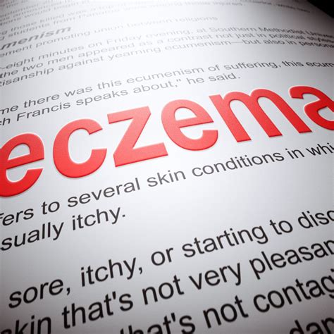 Eczema: Causes and Treatment – eaudeviestore