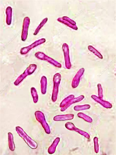 Clostridium botulinum - Stock Image - C021/4469 - Science Photo Library