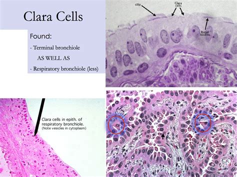 Respiratory - Clara Cells in Bronchioles - Histology | Cell, Respiratory, Student life hacks