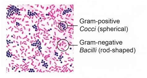 Why Does The Gram Positive Bacteria Stain Purple While Gram Negative ...