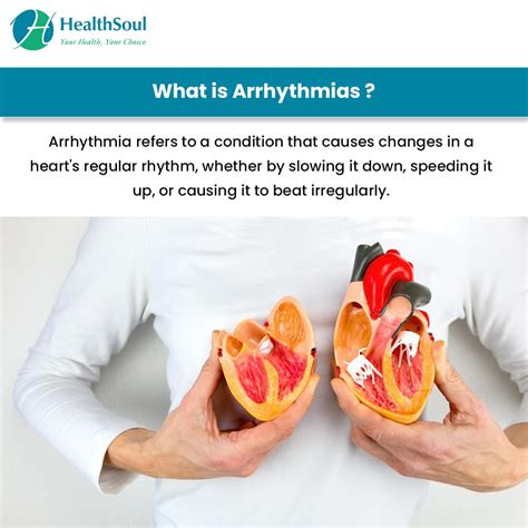 Arrhythmias: Causes and Treatment – Healthsoul