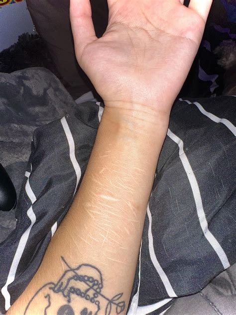 would a tattoo like this look okay over my scars? (healed sh scars) : r/tattooadvice