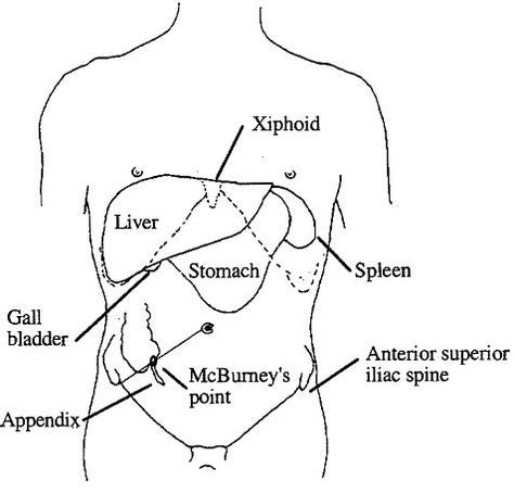 Gallery For > Mcburney Point | Nursing notes, Nurse life, Medical