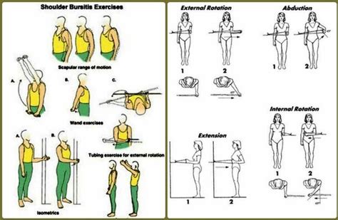 Shoulder Bursitis - Treatment, Exercises, What is, Symptoms