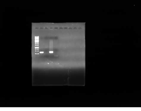 Solved Analyze The results of my Pcr | Chegg.com