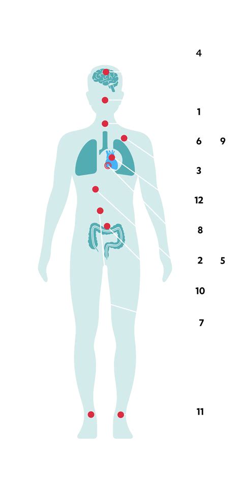 What is Pulmonary Arterial Hypertension? | JanssenWithMe