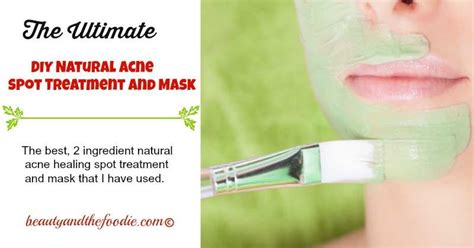 Ultimate Natural Acne Spot Treatment | Beauty and the Foodie