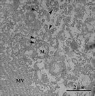 Pyriproxyfen, a juvenile hormone analog, damages midgut cells and interferes with behaviors of ...