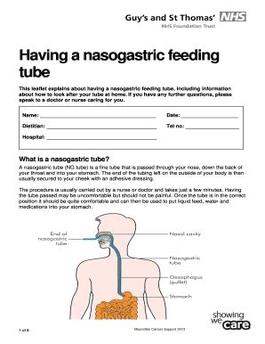 Nasogastric Tube Feeding Procedure - Fill Online, Printable, Fillable ...