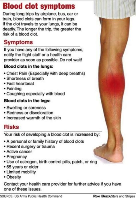 Peerless Info About How To Tell If I Have A Blood Clot In My Leg - Waterask