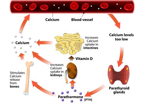 Vitamin D and Primary Hyperparathyroidism - GrassrootsHealth