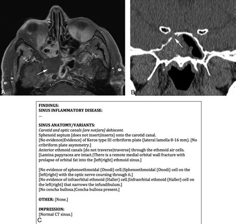 Radiology Reports: Who Reads Them, Who Writes Them, and How Do They Help? – Bluegrass Regional ...