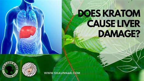 Kratom & Liver Damage - Does Kratom Cause Toxic Liver Disease or Liver Damage? - YouTube