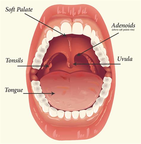 Tonsils and Adenoids. Causes, symptoms, treatment Tonsils and Adenoids