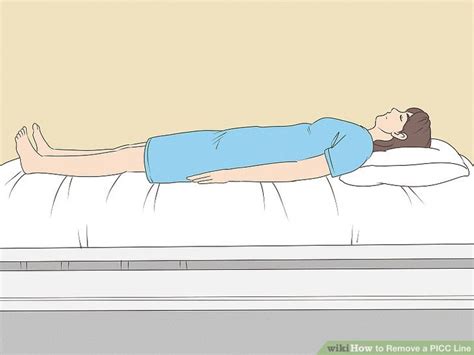 How to Remove a PICC Line: 12 Steps (with Pictures) - wikiHow