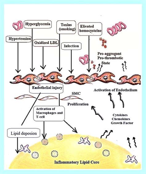 Shows endothelial injury progression for atherosclerosis initiation ...