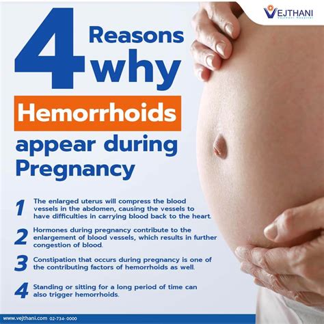 4 Reasons why Hemorrhoids appear during Pregnancy