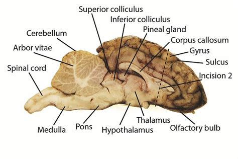 Pig Brain Dissection Internal Features Review Quiz - Quizizz