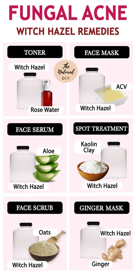 WITCH HAZEL FOR FUNGAL ACNE - The Natural DIY