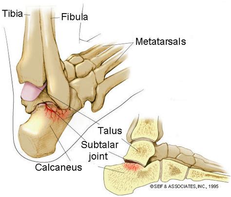 subtalar joint - Advanced Physical Therapy Specialists